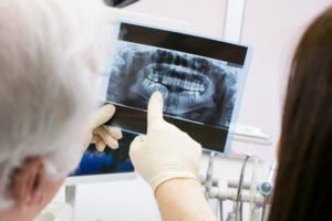 Dentist showing x ray to patient