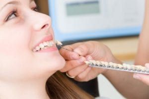 Dental Veneers checking