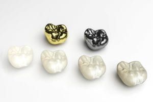 Different types of dental crowns on a white background