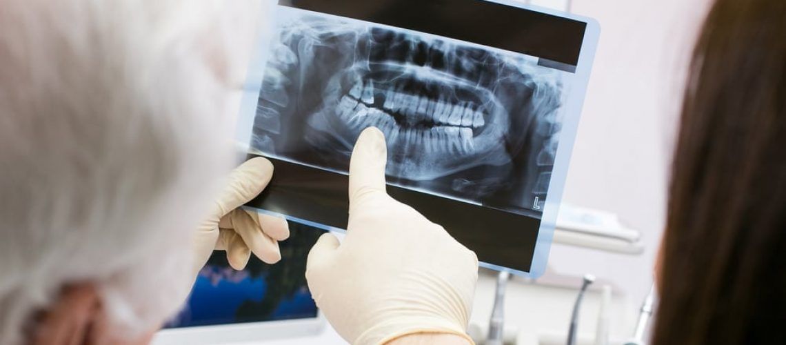 Dentist showing x ray to patient