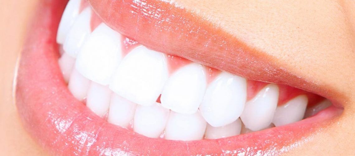 Teeth Whitening Female Picture